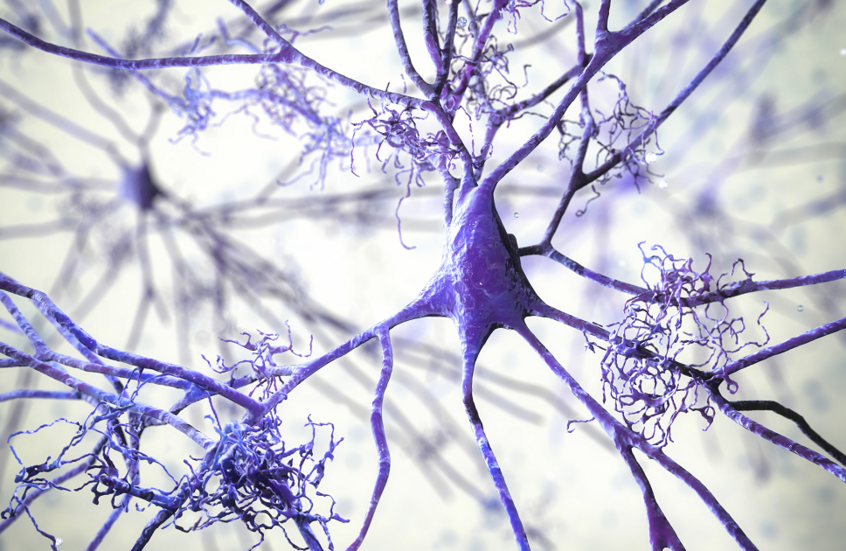 طب وصحة – أنشطة بسيطة مرتبطة بانخفاض كبير في خطر الإصابة بالخرف – الأخبار جديدنا – أخبارنا