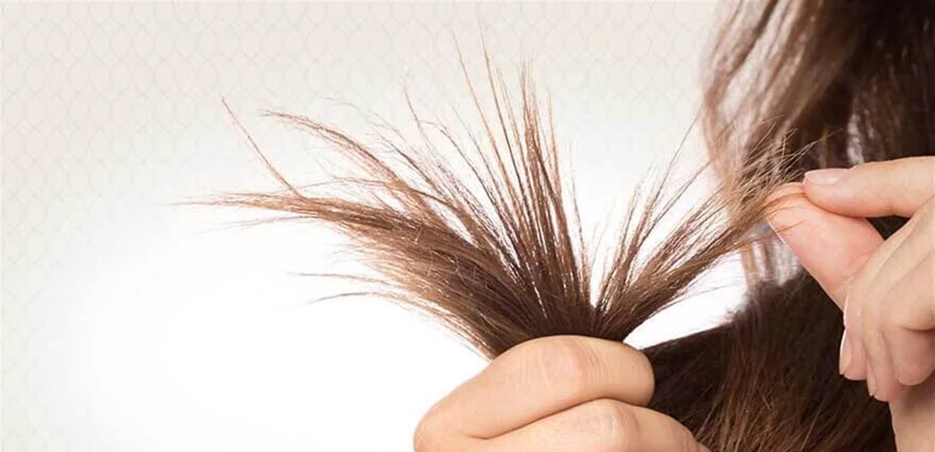 طب وصحة – ما الذي يسبب تساقط الشعر ومشاكل فروة الرأس عند النساء؟ – الأخبار جديدنا – أخبارنا