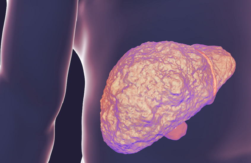 طب وصحة – الكولسترول.. خطر على صحة الكبد؟ – الأخبار جديدنا – أخبارنا